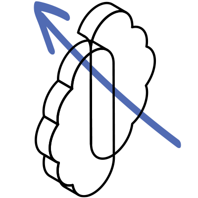 arrow bisecting two hemispheres of the brain